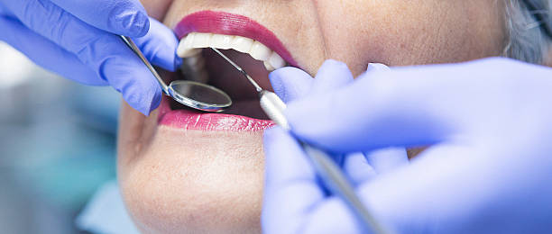 Best Emergency Broken Tooth Repair in Helena Valley Northwest, MT